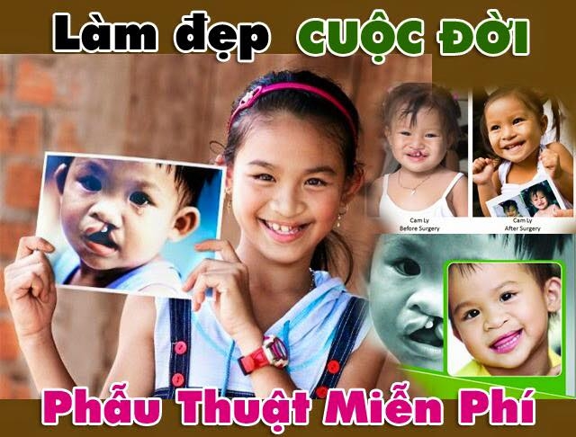 Phẫu[-]thuật[-]dị[-]tật[-]hàm[-]mặt[-]niễn[-]phí[-]tại[-]TP.[-]HCM